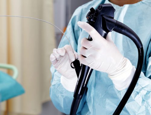 Endoscopia